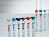 Minituburi pentru determinari hematologice (100 buc/pachet)